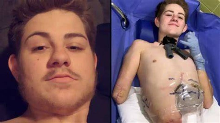 Man chopped in half by forklift bravely goes swimming…