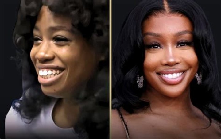 SZA Confirms the Plastic Surgery Procedure She’s Had Done, Explains Why