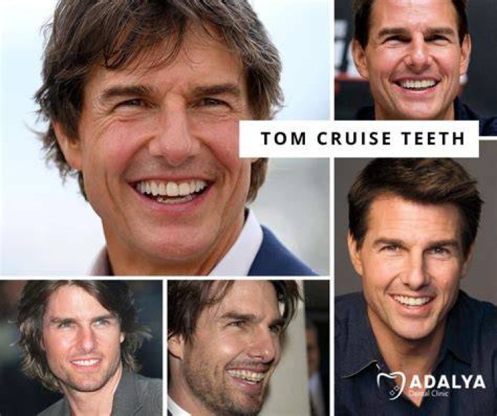 Unveiling The Secrets Behind Tom Cruise's Early Teeth: Discoveries And Insights